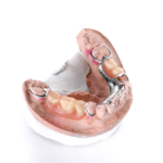 Dentures-4-1000x1000
