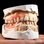 Dentures-9-1000x1000